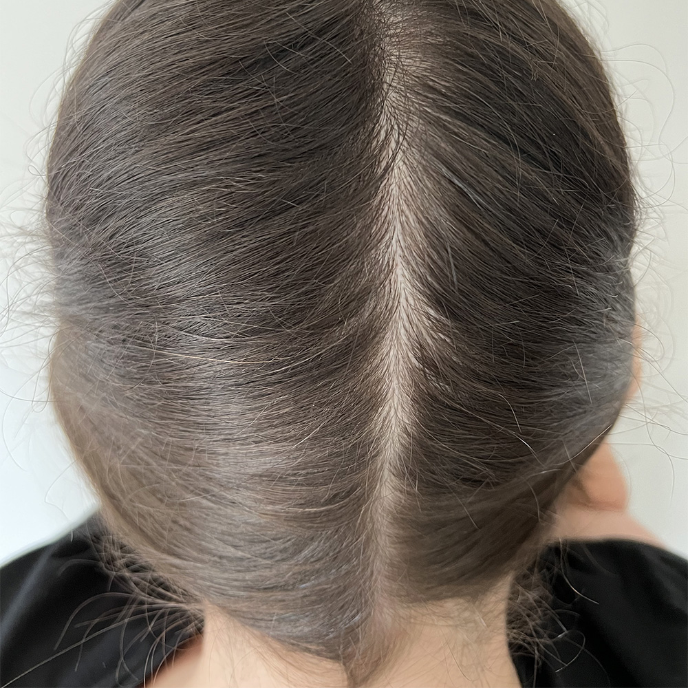 Back_Parting