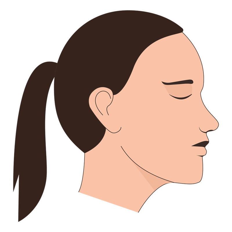 Female-Hair-Loss-07_1