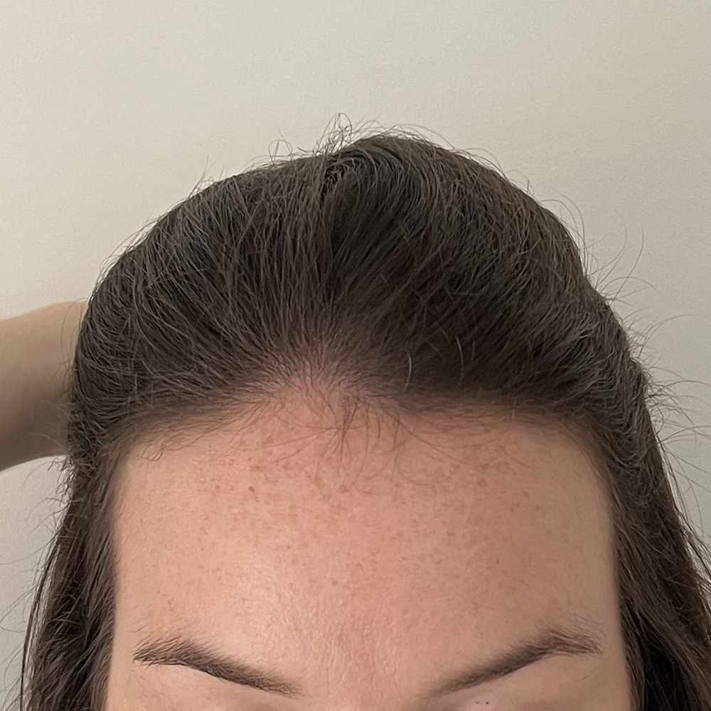 Frontal