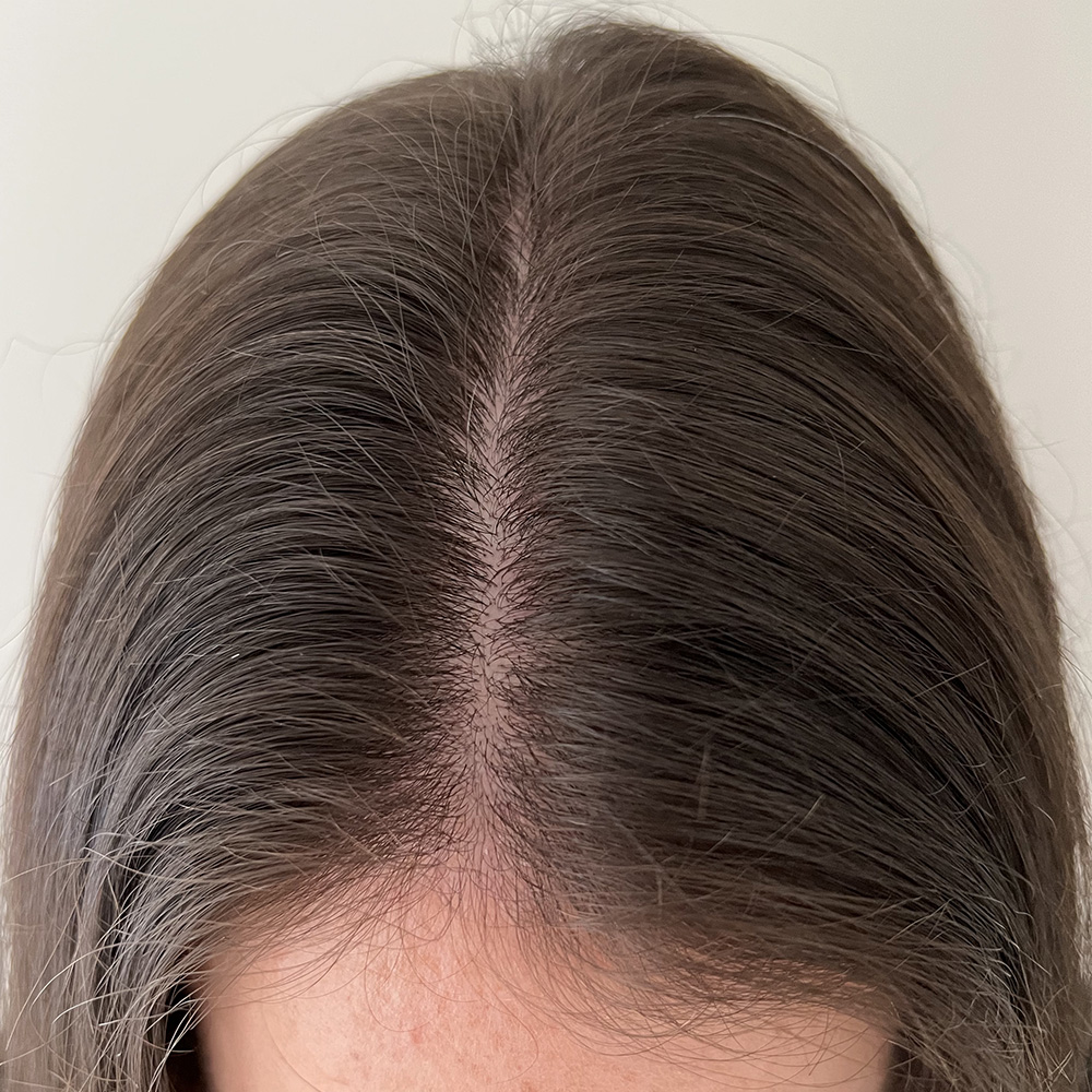 Frontal_Parting