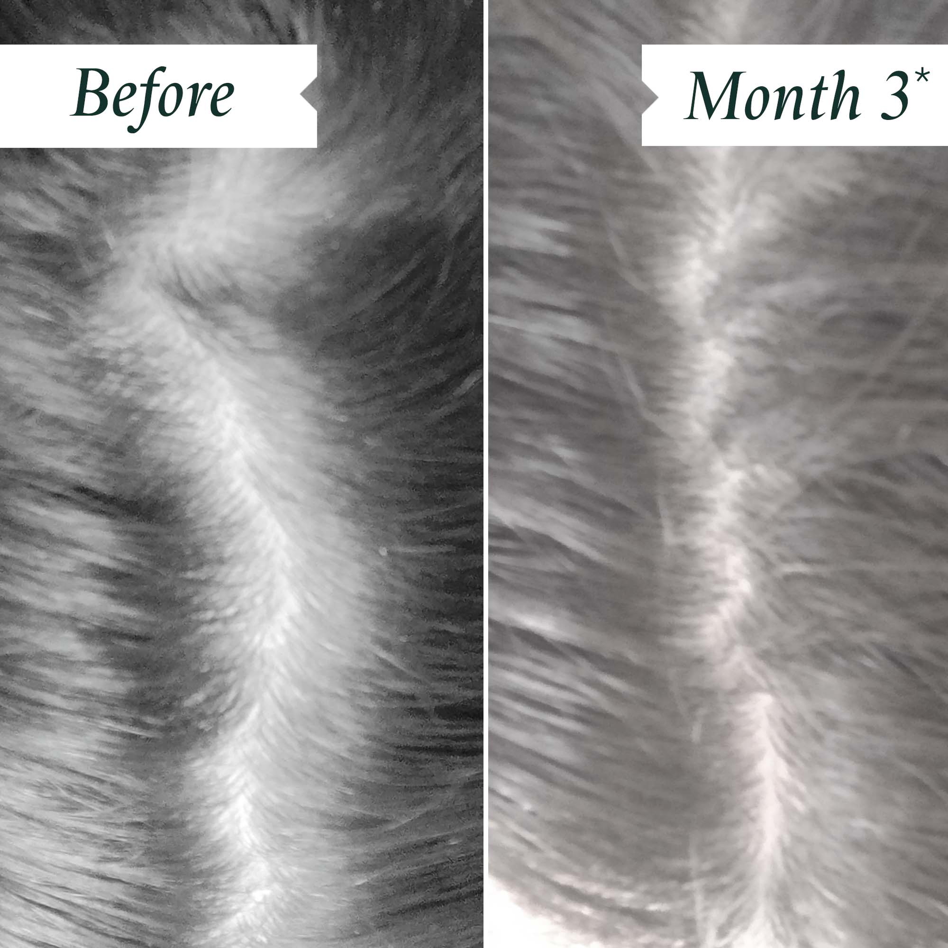 INDEPENDENT USER TRIAL – BEFORE AND AFTER 3 MONTHS OF CONTINUED DAILY USAGE OF DENSITY PRESERVING SCALP DROPS.