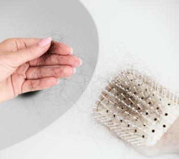 How Weight Loss Medications Impact Hair Loss? 